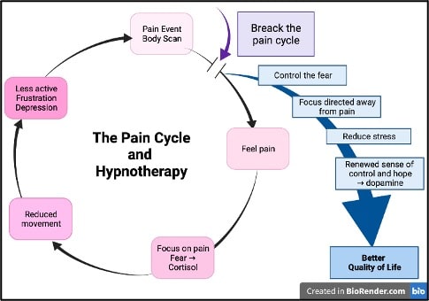 pain relief and hypnotherapy